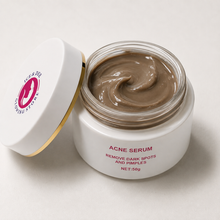 Lade das Bild in den Galerie-Viewer, Ice & Dee Acne Serum (Cream)