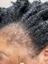 Load image into Gallery viewer, Ice & Dee Skin Spot Corrector, great for erasing spots on face and body 60g