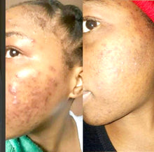 Load image into Gallery viewer, Ice & Dee Skin Spot Corrector, great for erasing spots on face and body 60g