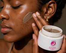 Lade das Bild in den Galerie-Viewer, Ice &amp; Dee Acne Serum (Cream)
